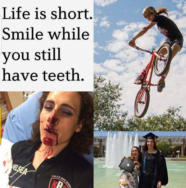 Chelsea Wolfe teeth
