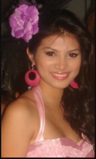 Jinky Serrano Before Surgery Photo
