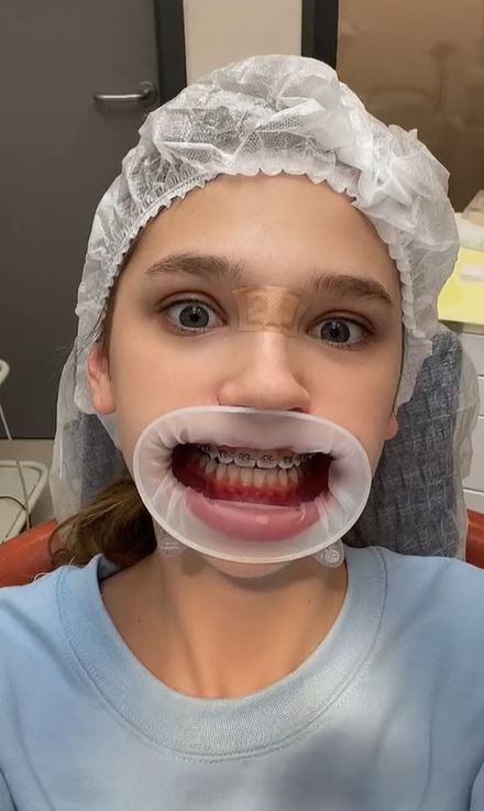 Liza Anokhina during visit to dentist
