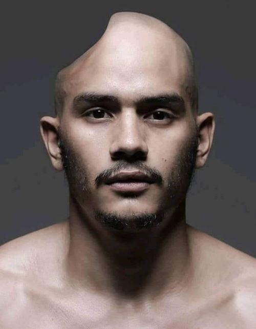 Kiko Matos deformed head