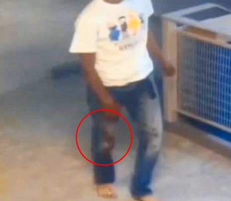 Philip's pant was covered with blood