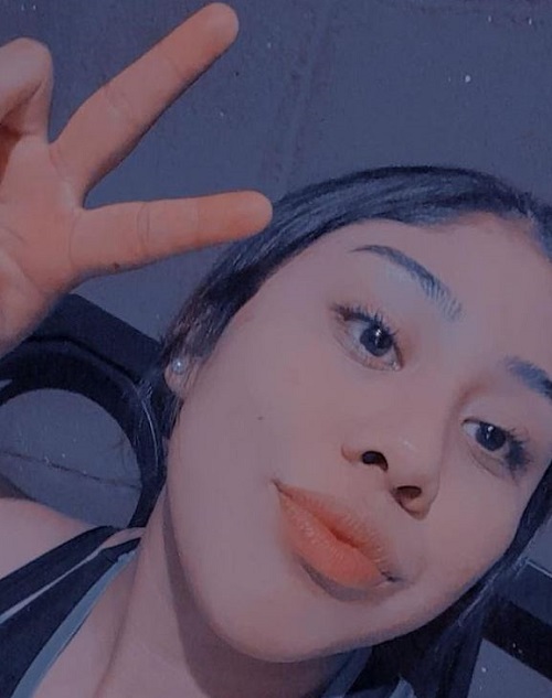 Jeanette Zacarias Zapata suffered brain injury and died on September 02, 2021
