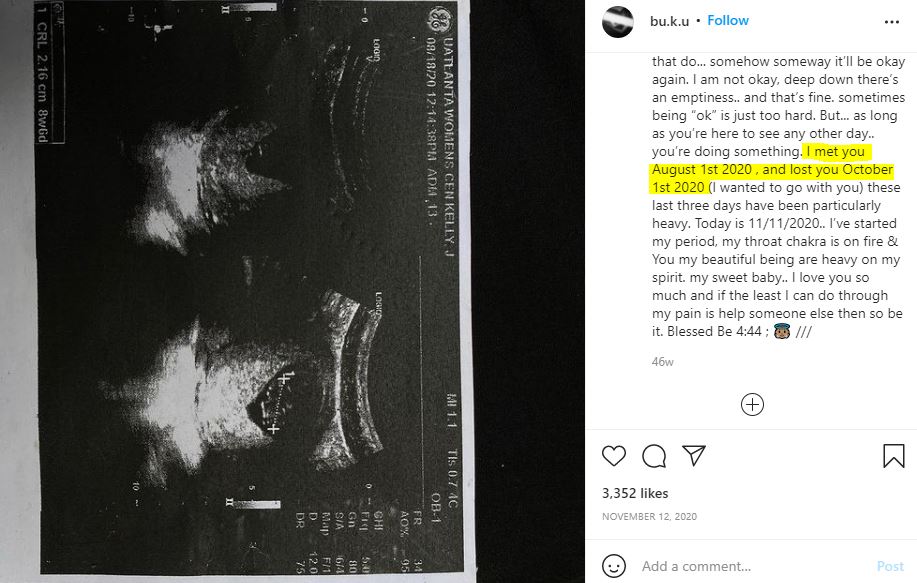 Joann Kelly survived a miscarriage