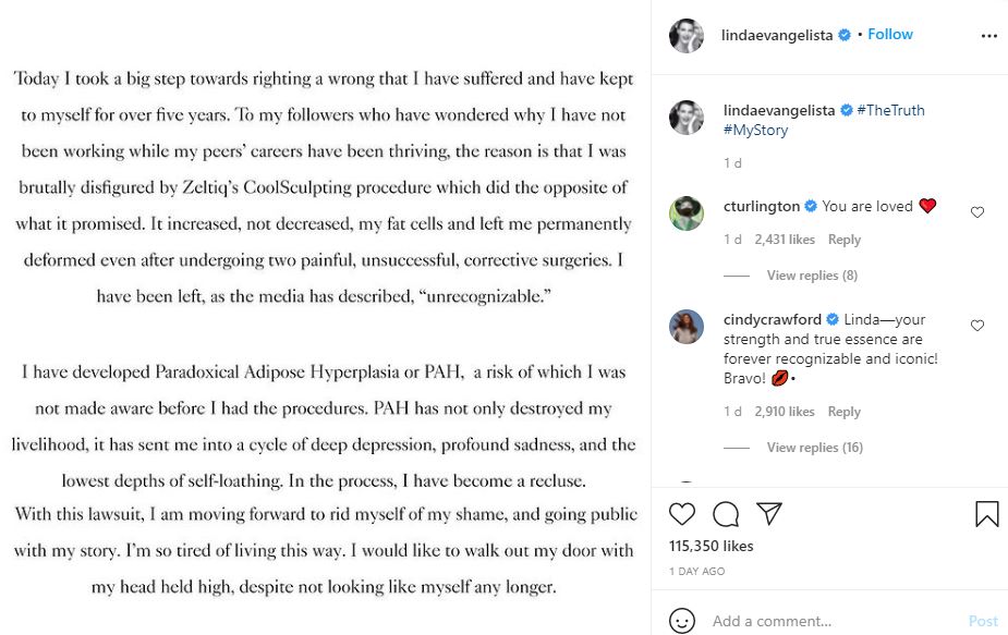 Linda Evangelista disclosed that she was left deformed