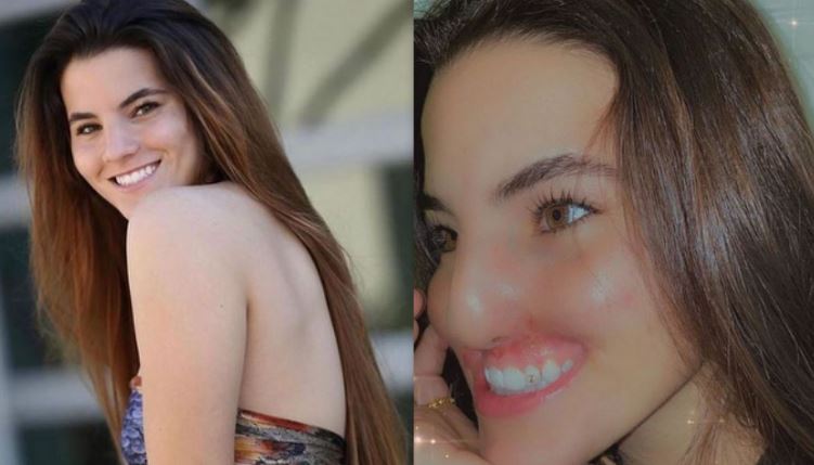 Brooklinn Khoury's face after Pitbull attack