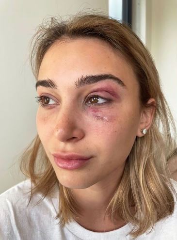 Camaryn Swanson physically assualted by Tyga