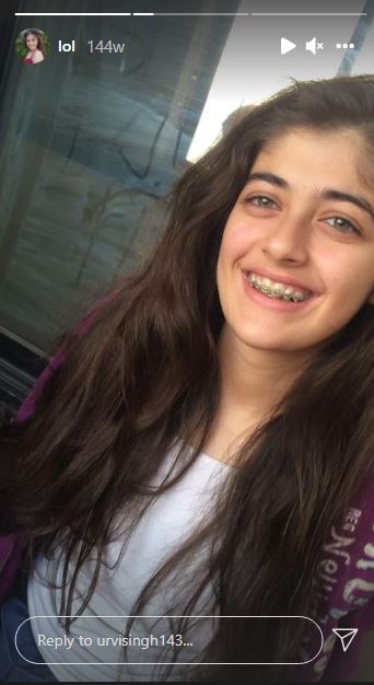 Urvi Singh used braces