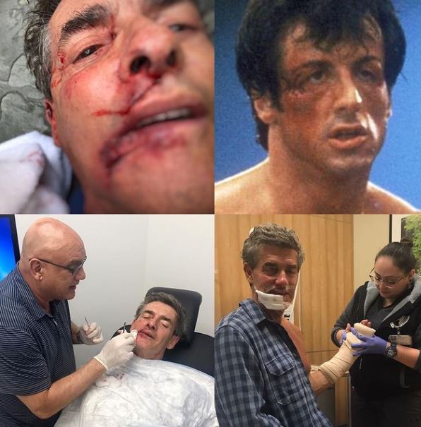 Dominique Sachse's husband's accident