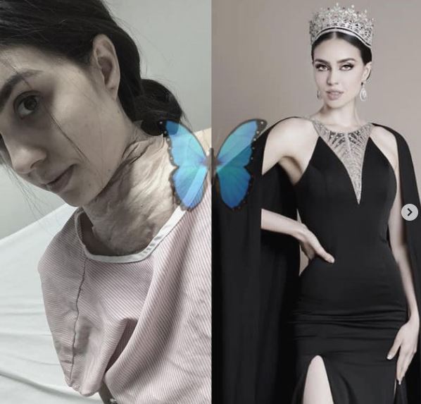 Debora Hallal went through thyroid surgery