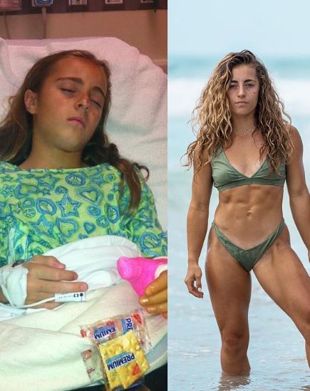 Demi Bagby was paralyzed for three months