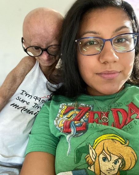 Adalia Rose with her mother Natalia Amozurrutia