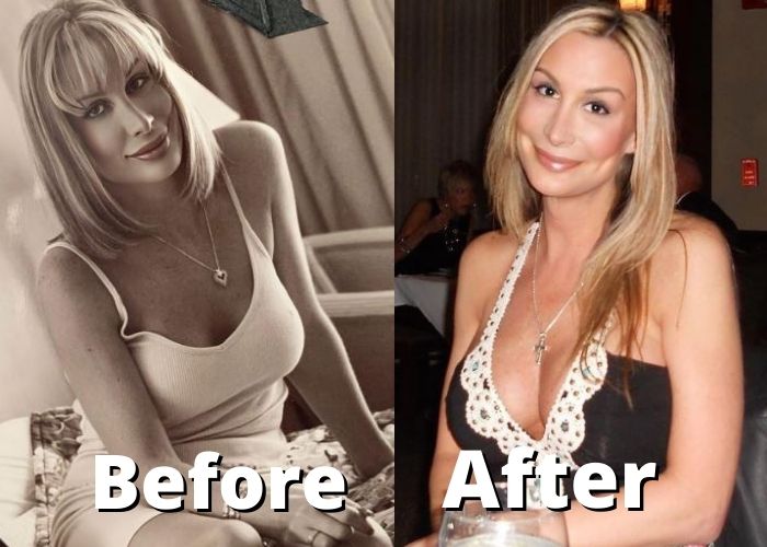 Taylor Lianne Chandler before and after
