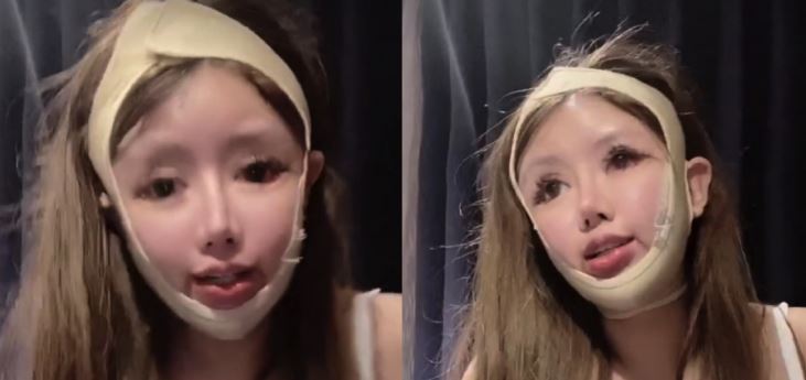Zhou underwent over 100 surgeries