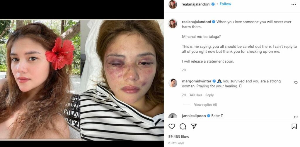 Ana Jalandoni IG post