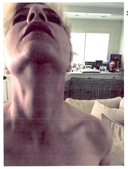 Carlson is accused of physically attacked his ex Selma Blair