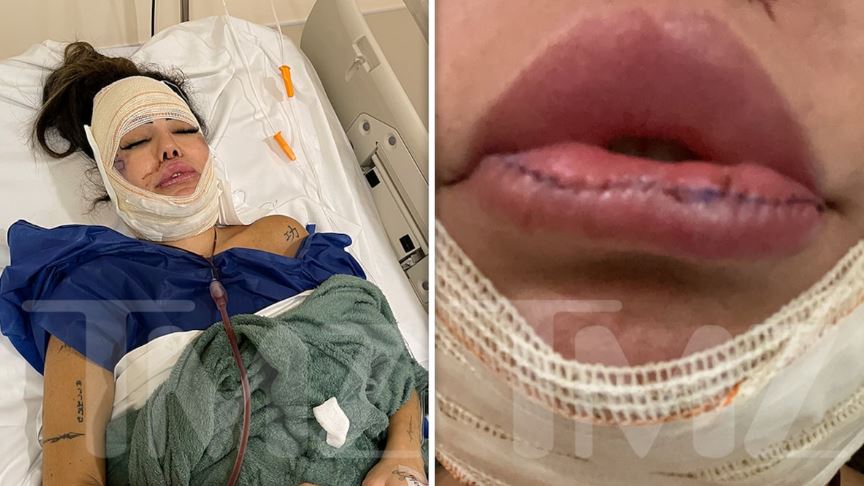 Liziane Gutierrez post surgery condition