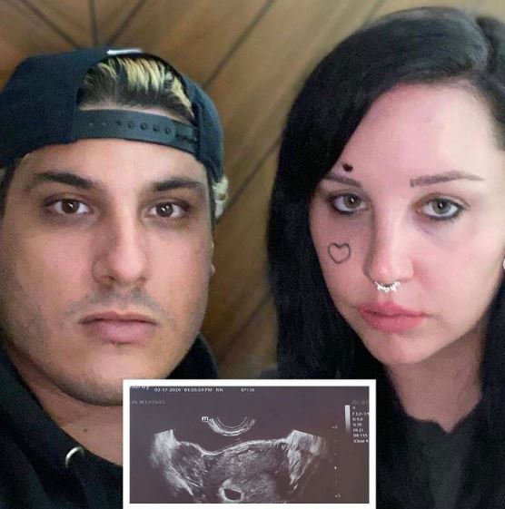 Paul and Amanda Bynes expected a baby