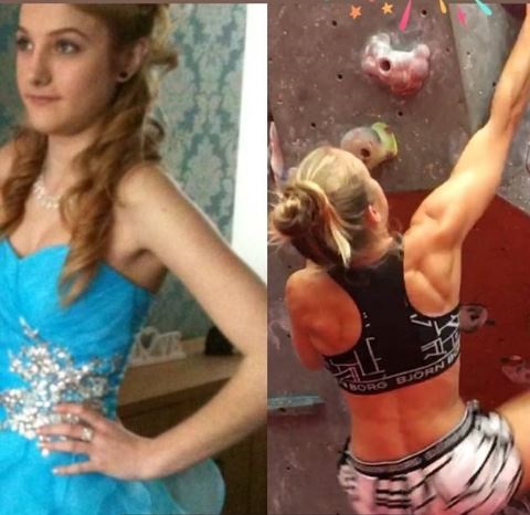 Mercedes Valentine Before and After Photo