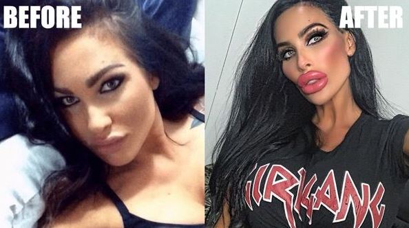 Tara Jayne's before and after plastic surgery photo