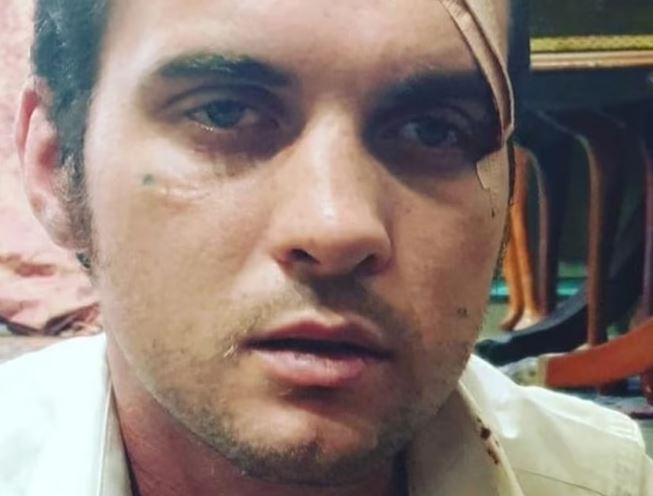 Jethro Lazenby arrested for assualting his mother