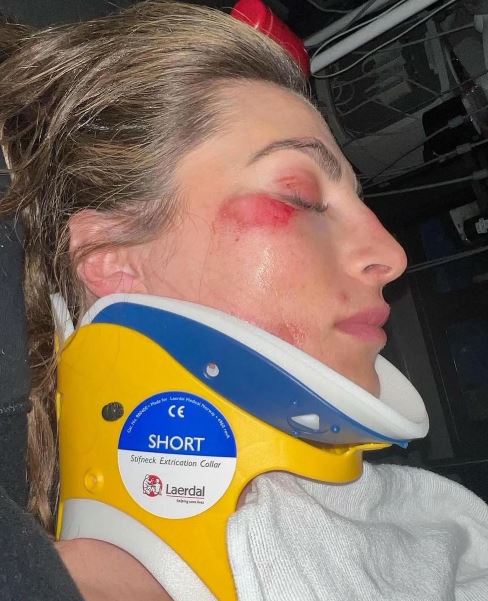 Camille hospitalized after face-planting at epic July 4th bash