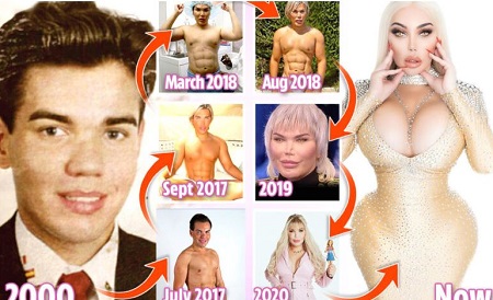 Jessica Alves Before Plastic Surgery & After Plastic Surgery (No Makeup)