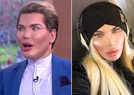 Jessica Alves Before and after