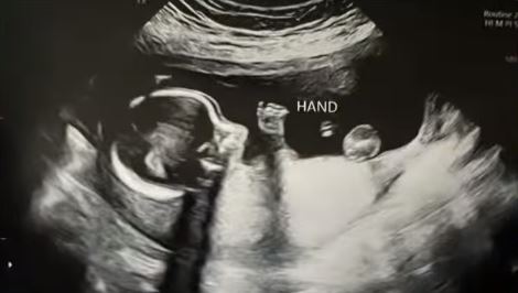 Hillary Vaughn baby scan