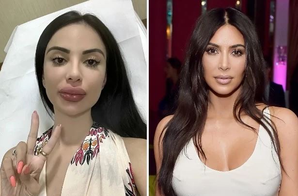 Jennifer underwent surgeries to look like Kim Kardashian