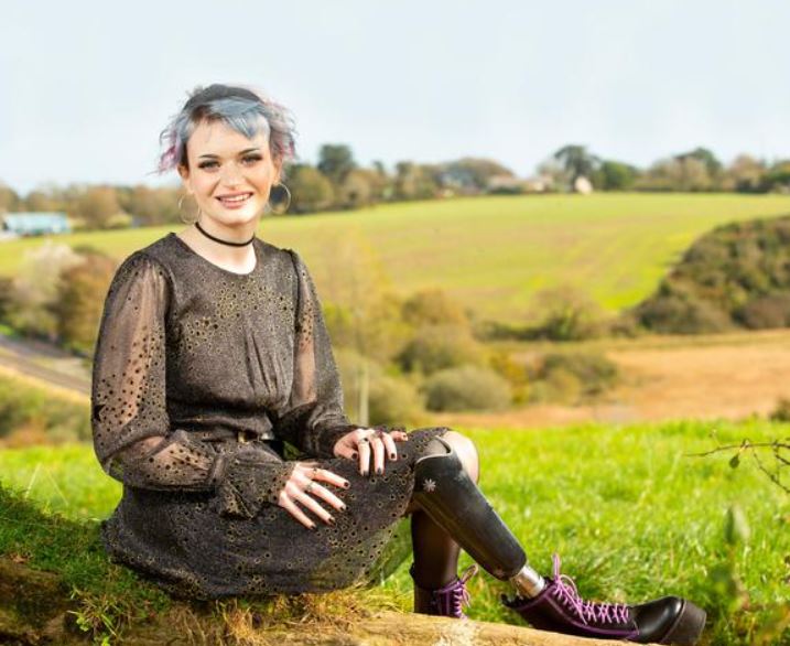 Ruth Codd is an Amputee