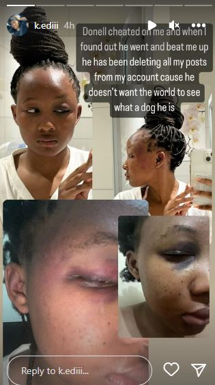 Donell has been accused on rape and physical assualt his girlfriend Reokeditswe