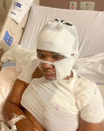 Rolling Ray underwent surgery
