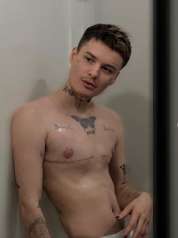 Jesse Sullivan chest surgery
