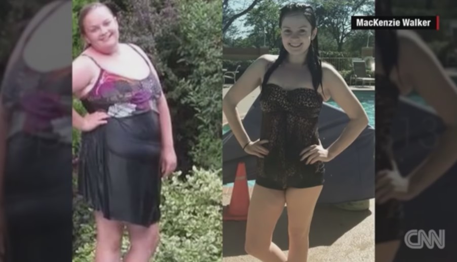 Mackenzie Walker Weight Loss Before After Photo