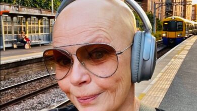 Gail Porter Illness and Health Update What Happened to Gail Porter From Alopecia to Fractured Skull