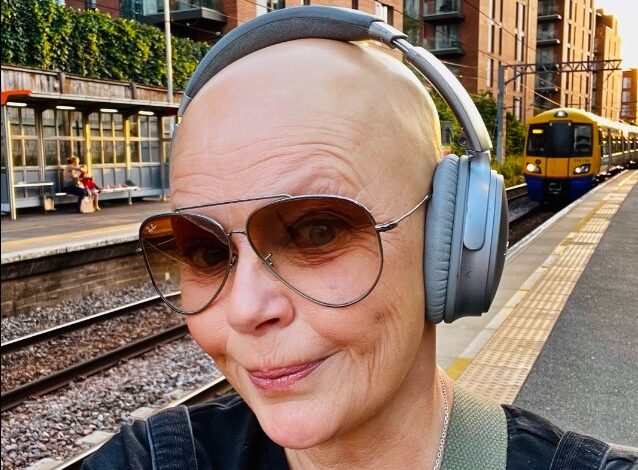 Gail Porter Illness and Health Update What Happened to Gail Porter From Alopecia to Fractured Skull