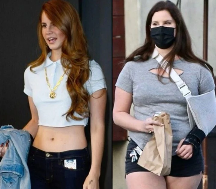 Lana Del Rey weight gain